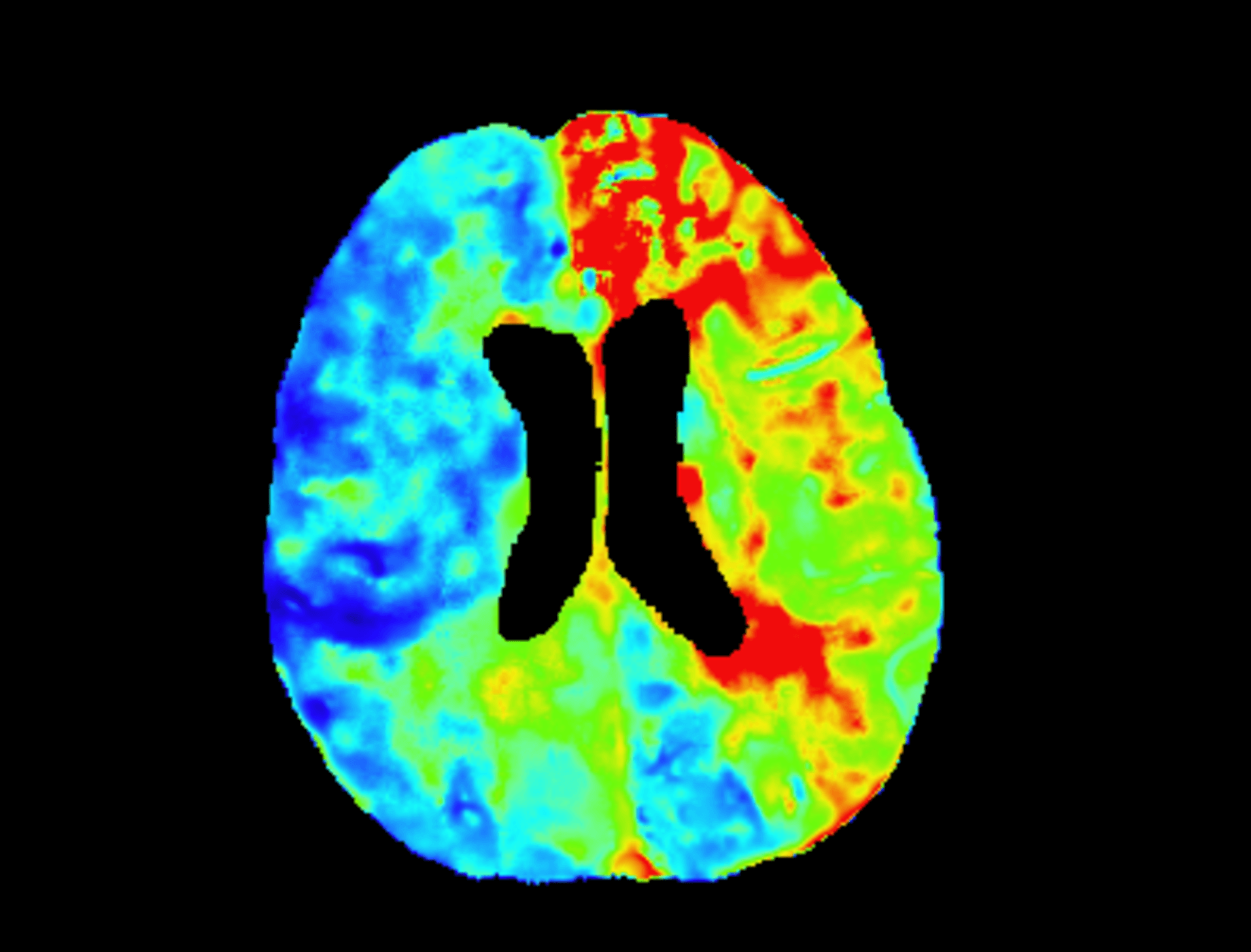 United Neuro (uWS, uReal, uSmart) | United-Imaging Healthcare