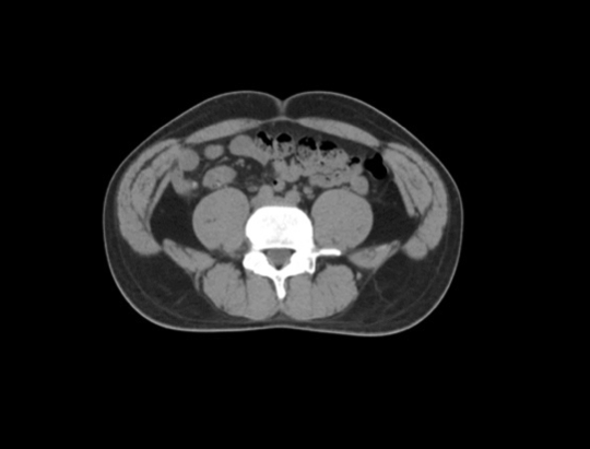 Intelligent Outlining Speed in Seconds Small Changes in Target Area Can Be Applied to Clinical Applications