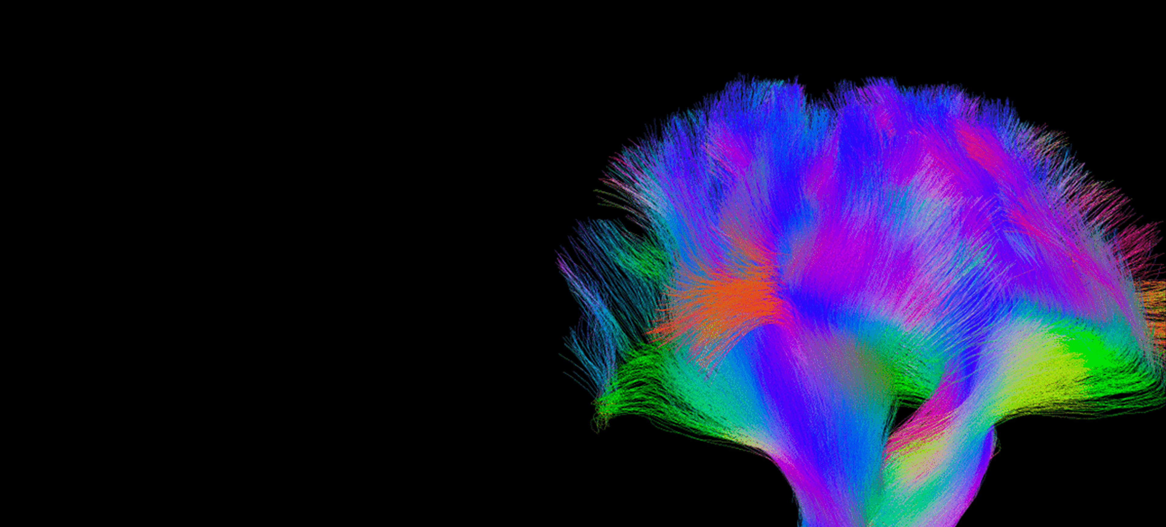 Multicolored image of the neural connections within a brain