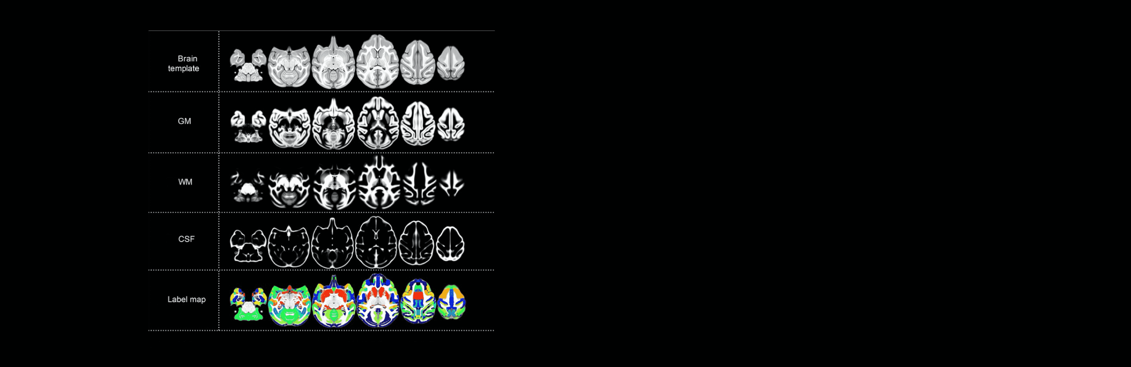 Individual Brain Differences Based on a Population MRI-Based Atlas