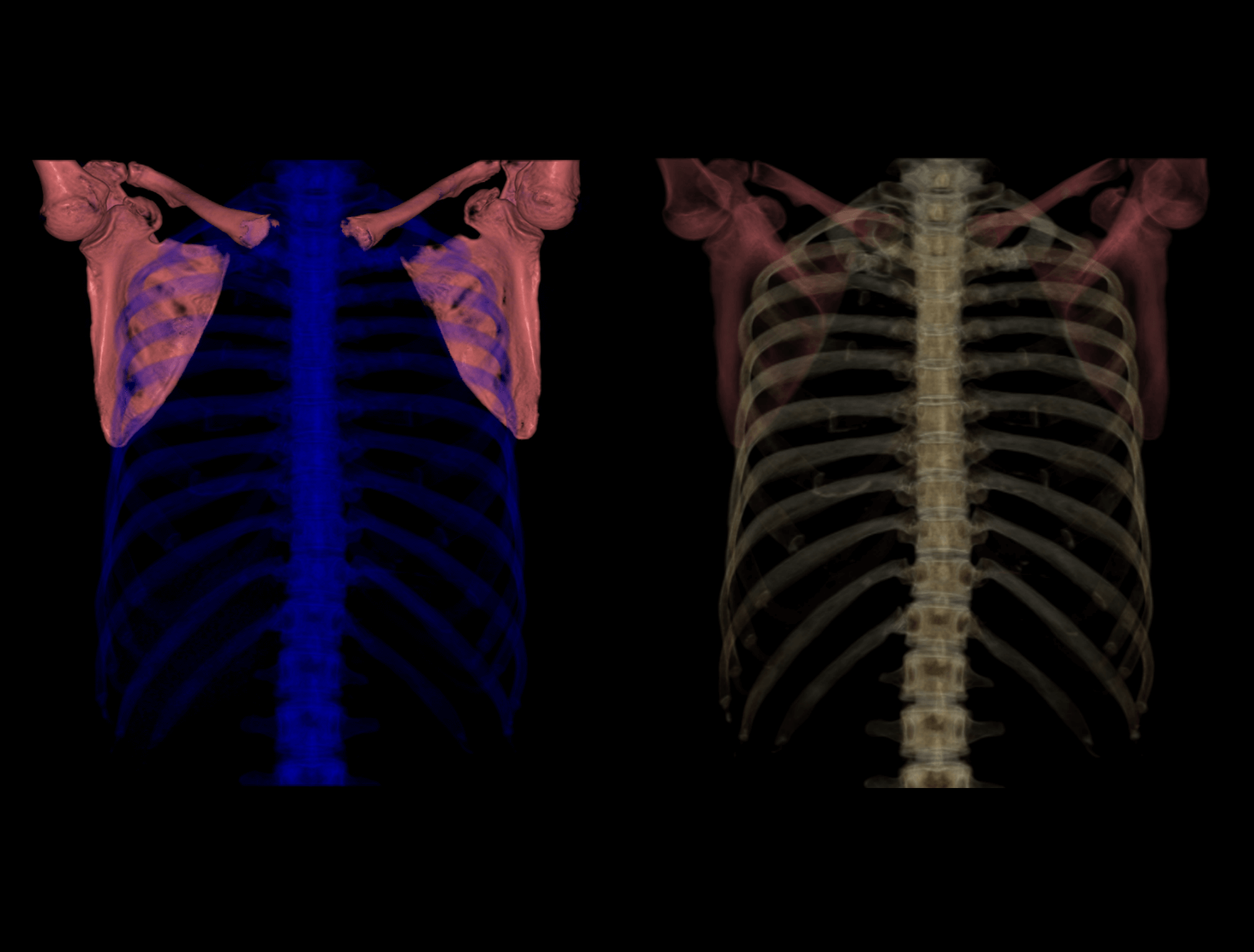 Review 3D - Hip Joint
