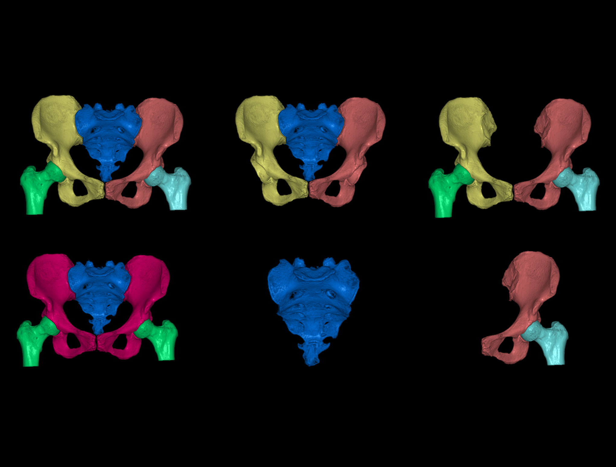 Review 3D - Hip Joint