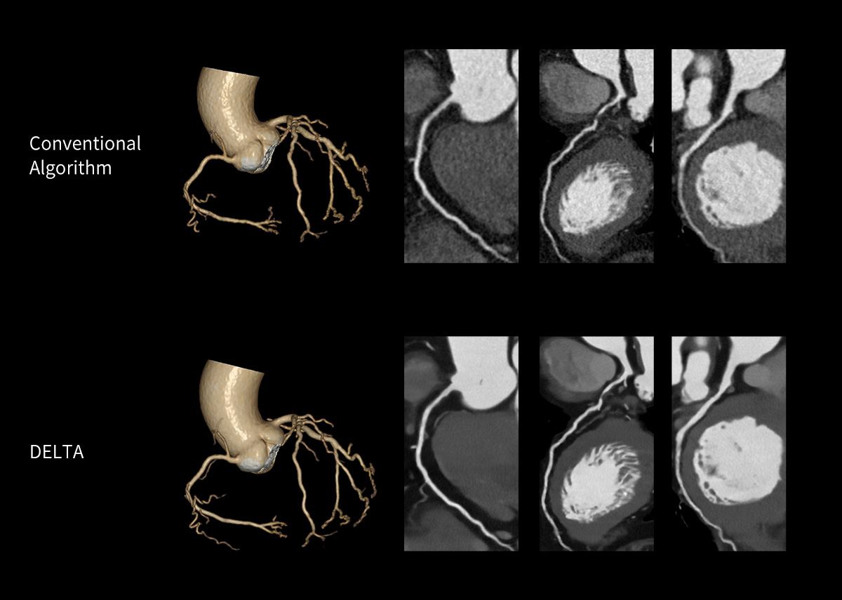 uCT 780 (Fine Sampling+ low Noise+ GOS) | United-Imaging