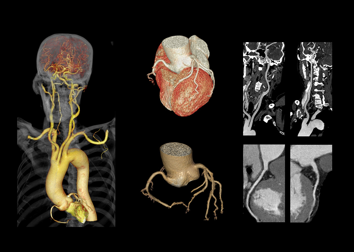 uCT 780 (Fine Sampling+ low Noise+ GOS) | United-Imaging