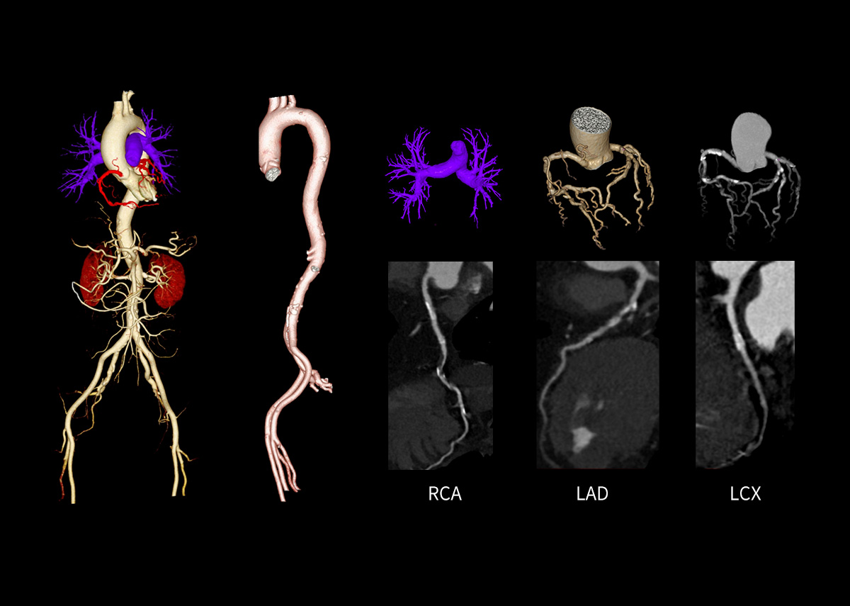 uCT 780 (Fine Sampling+ low Noise+ GOS) | United-Imaging