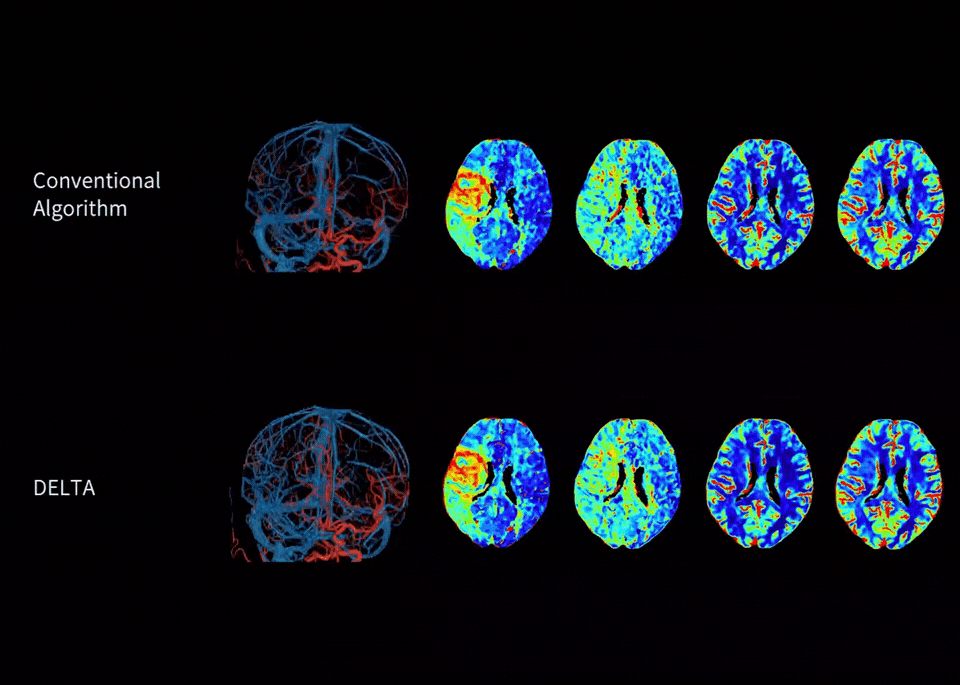 uCT 780 (Fine Sampling+ low Noise+ GOS) | United-Imaging