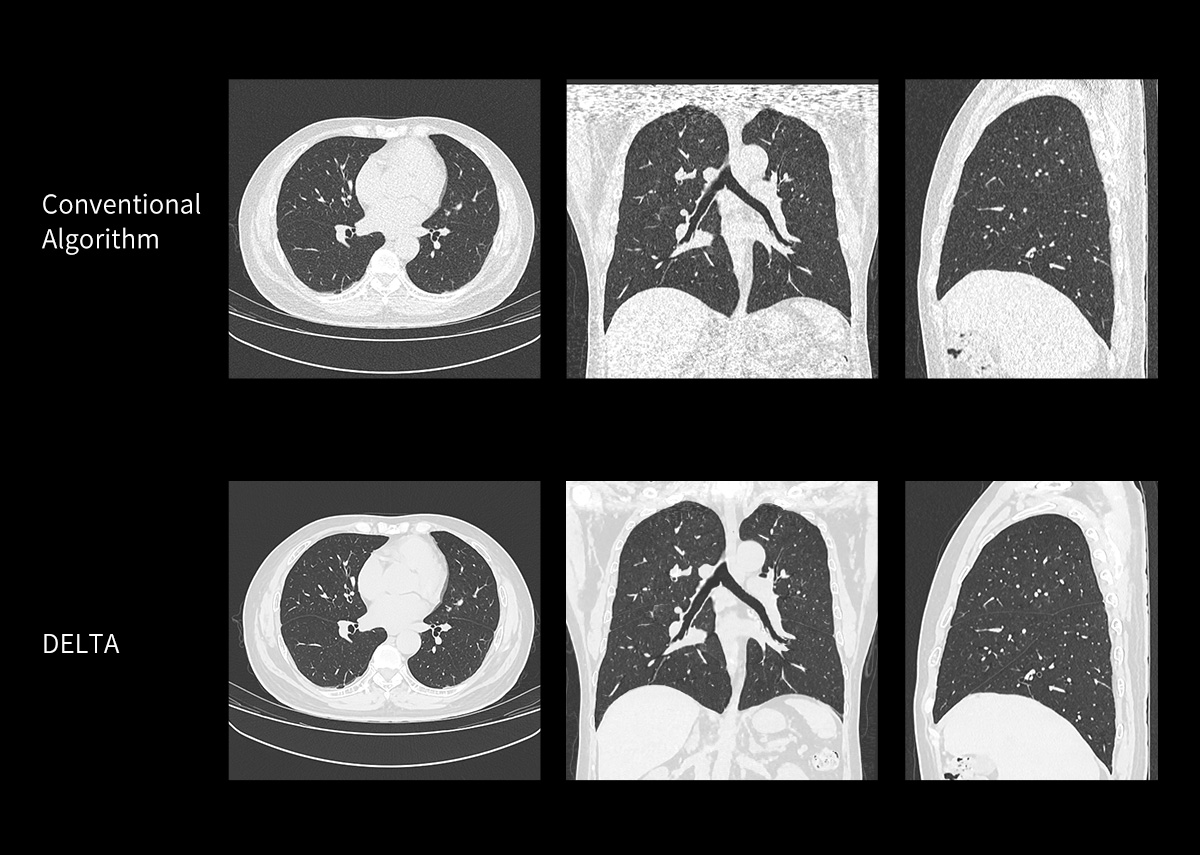 uCT 780 (Fine Sampling+ low Noise+ GOS) | United-Imaging