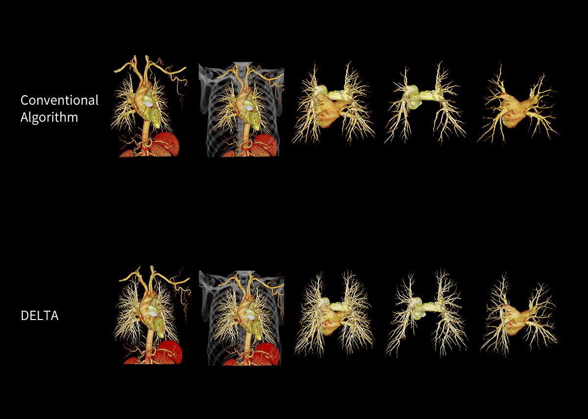 uCT 780 (Fine Sampling+ low Noise+ GOS) | United-Imaging