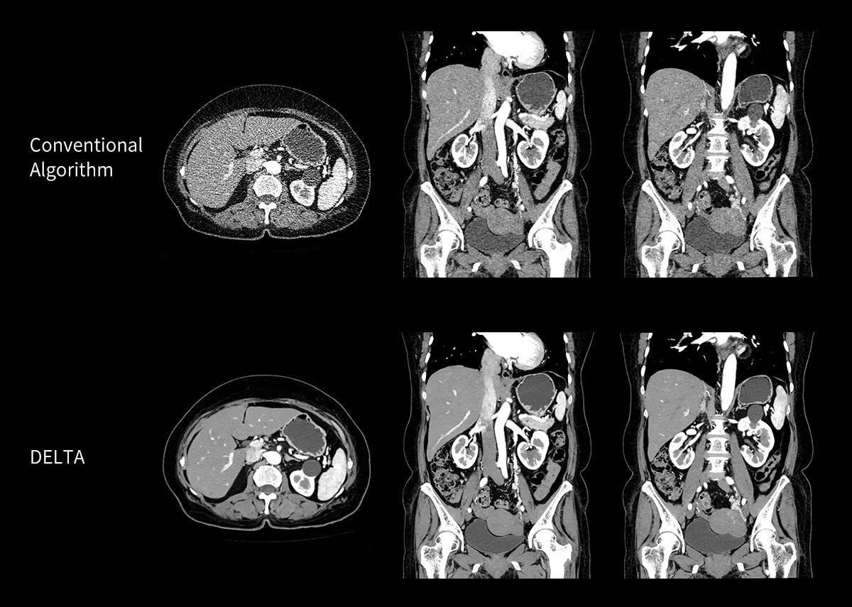 uCT 780 (Fine Sampling+ low Noise+ GOS) | United-Imaging