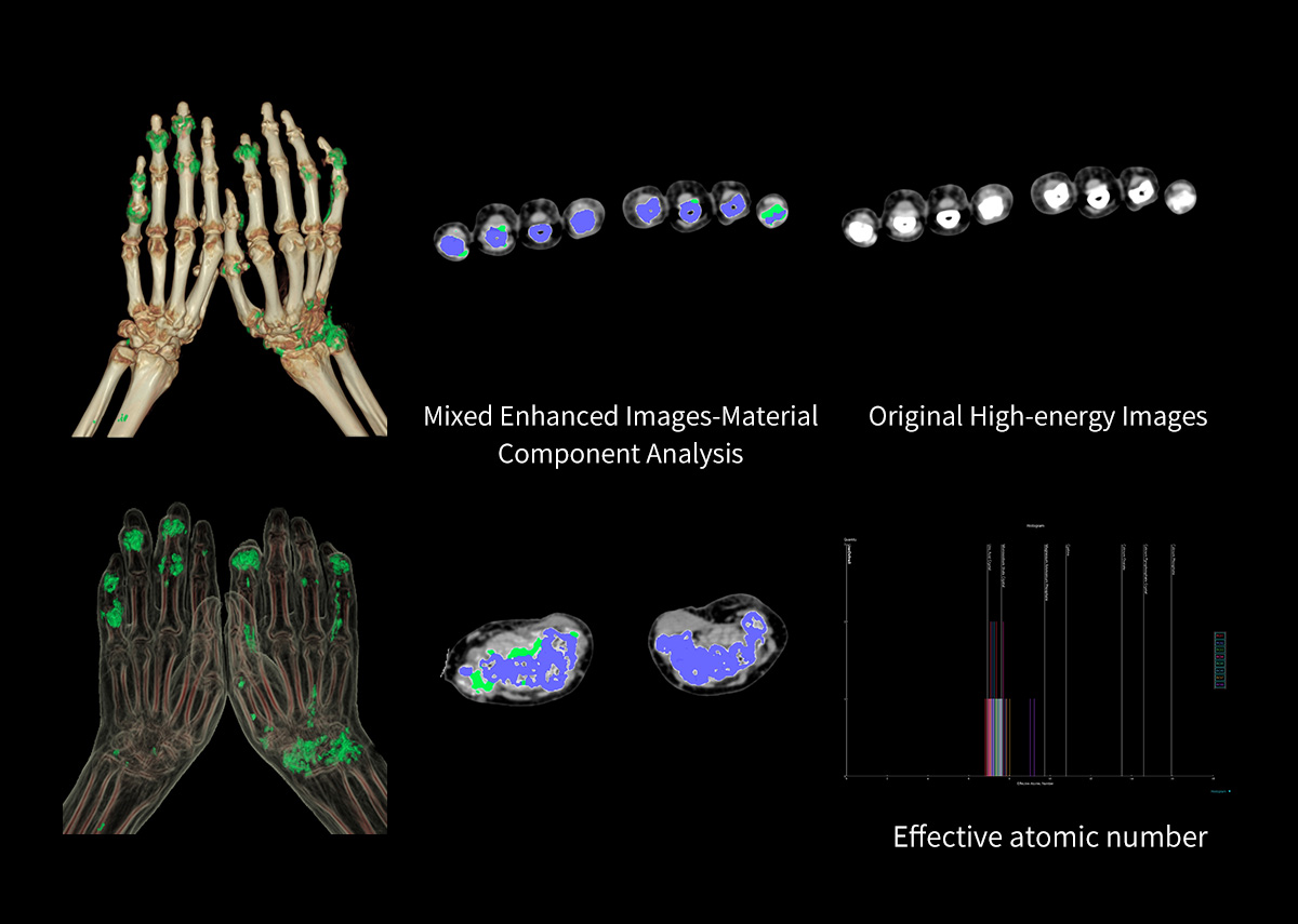 uCT 780 (Fine Sampling+ low Noise+ GOS) | United-Imaging