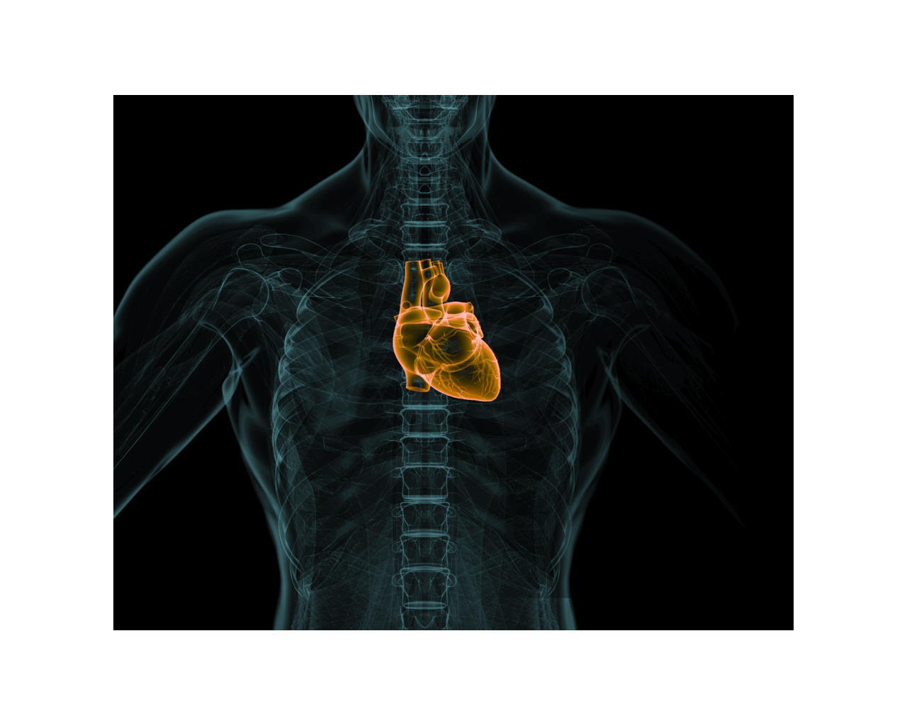 uCT 780 (Fine Sampling+ low Noise+ GOS) | United-Imaging