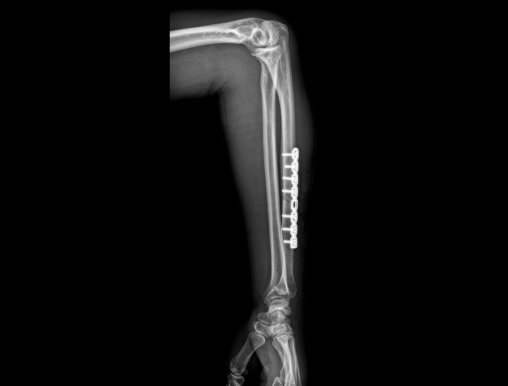 uDR 566i, digital medical X-ray imaging system