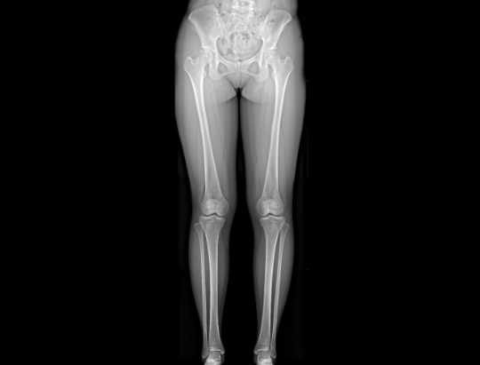 Long bone image​