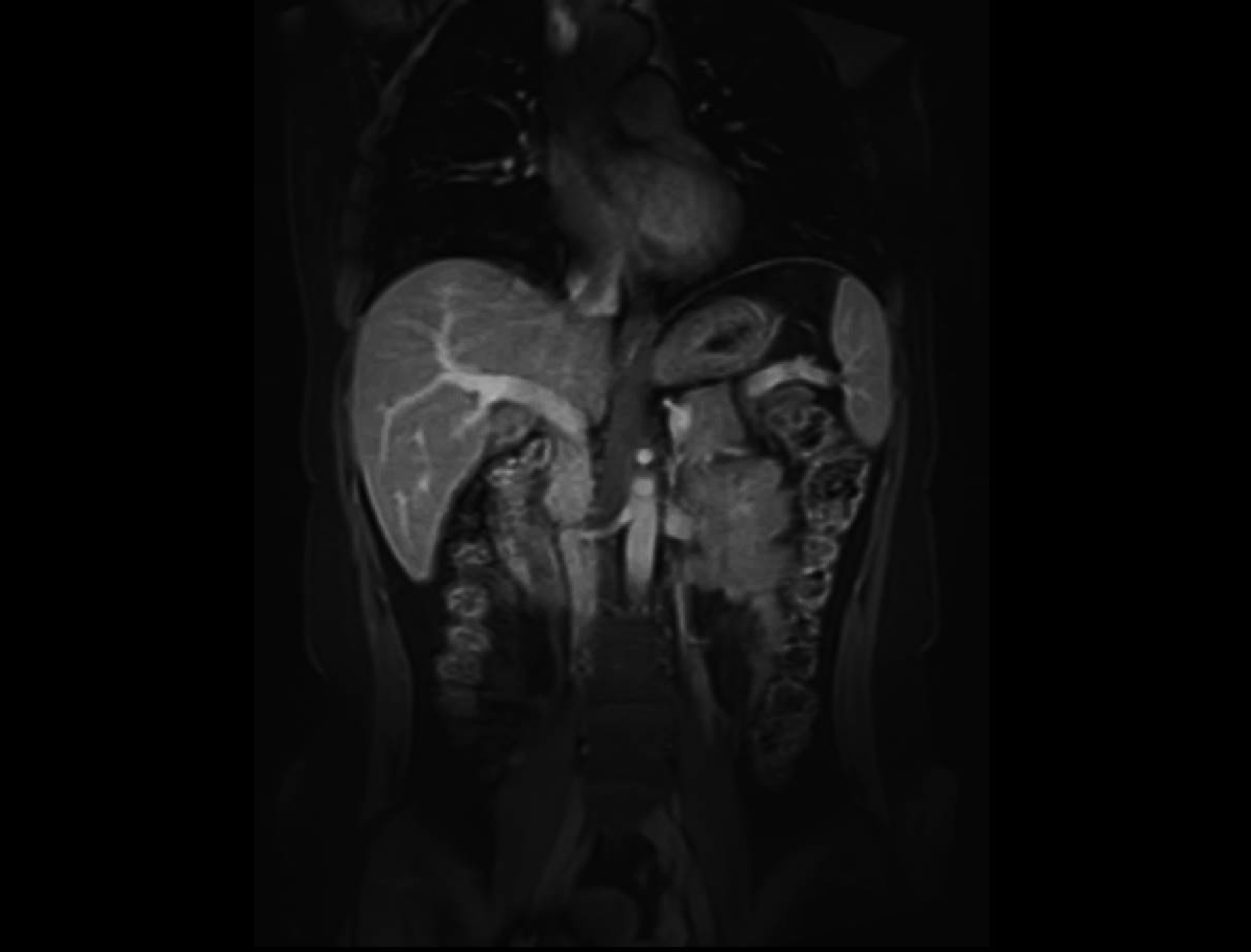 T1W QUICK 3D FS imaging