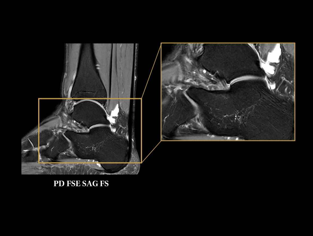 ankle imaging with detail enlargement