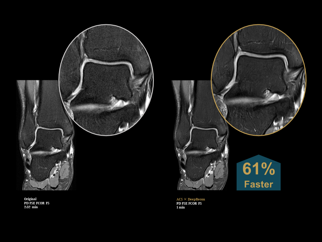 ankle imaging with detail enlargement