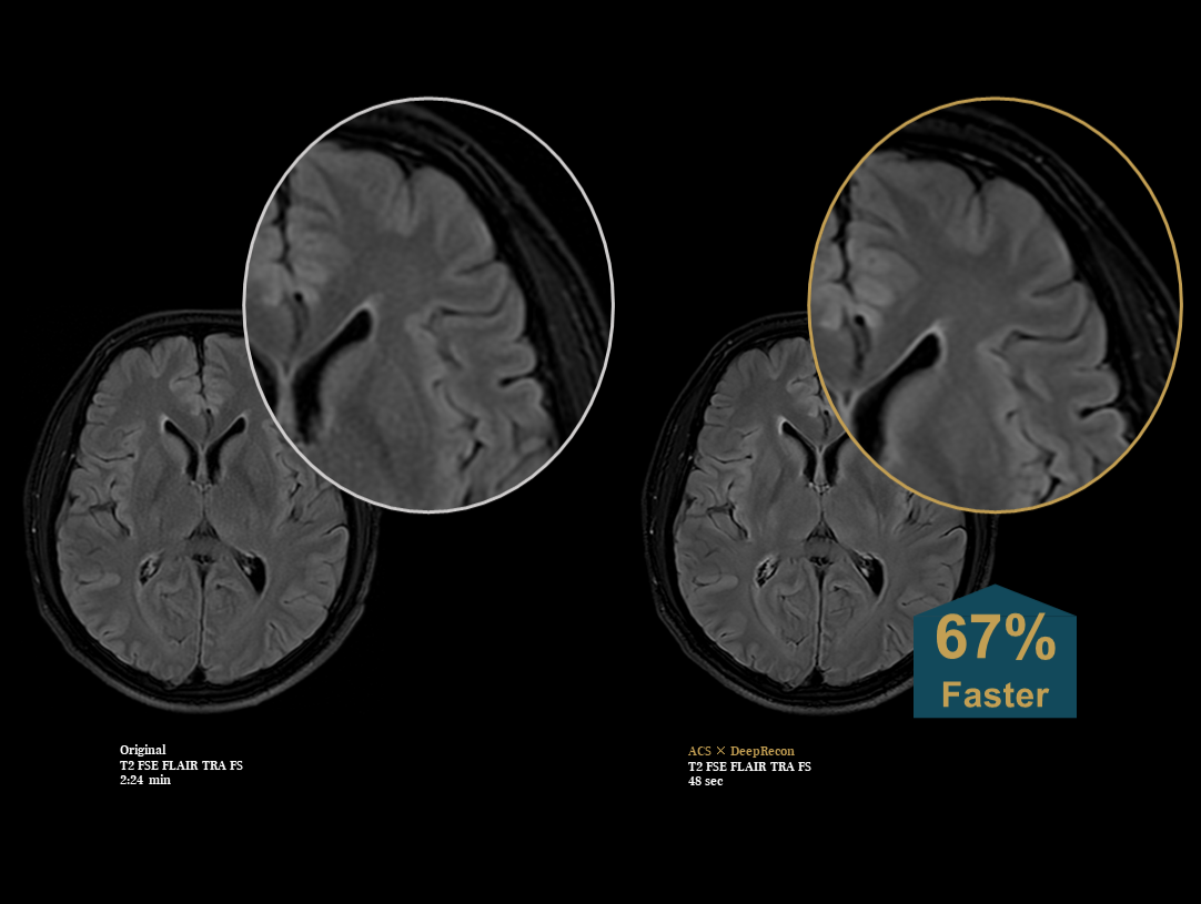 ankle imaging with detail enlargement