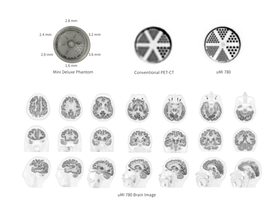 numerous fine brain images from uMI 780 contrasting to conventional PET/CT