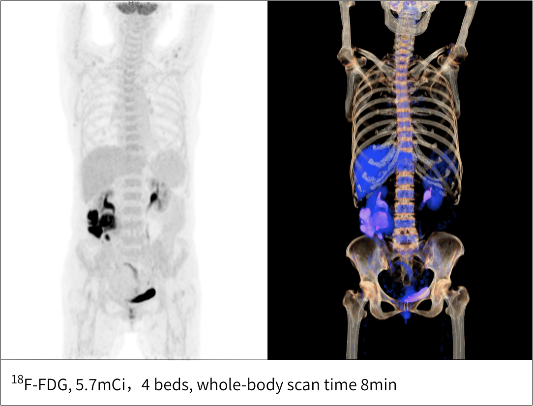 a patient's whole-body scan taking only 8 minutes