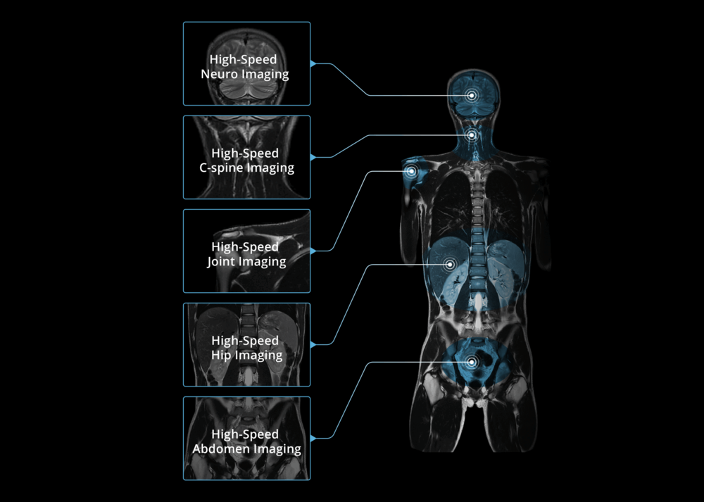 human body imaging featuring high speed in neuron, C-spine, joint, hip, and abdomen