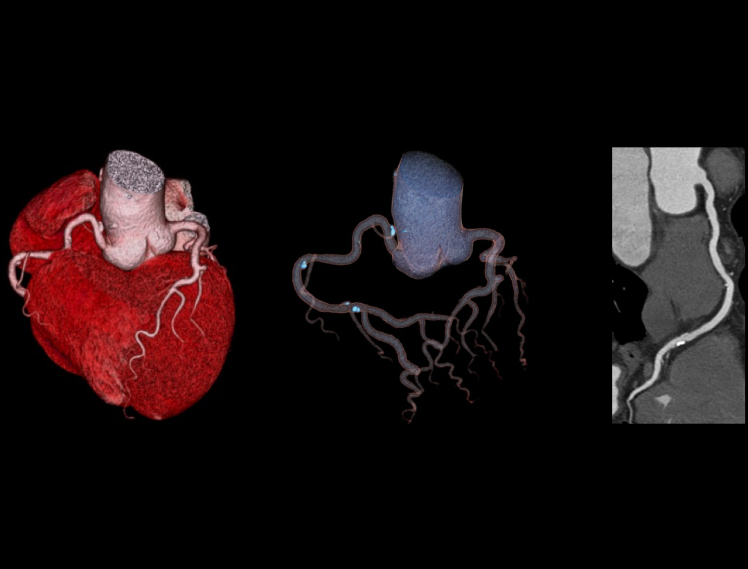 uCT 780 (Fine Sampling+ low Noise+ GOS) | United-Imaging