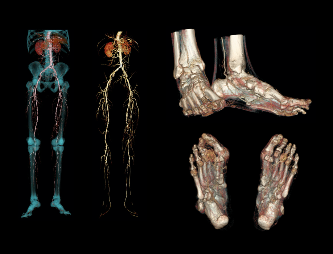 uCT 780 (Fine Sampling+ low Noise+ GOS) | United-Imaging