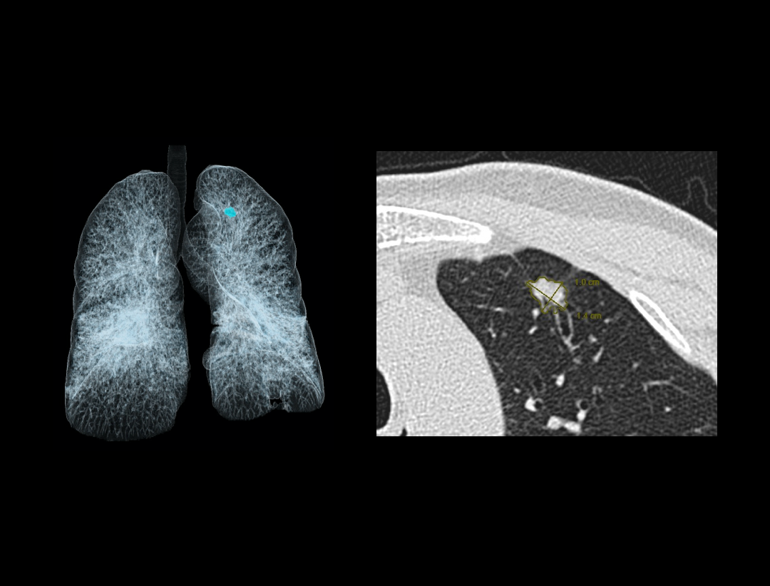 uCT 780 (Fine Sampling+ low Noise+ GOS) | United-Imaging