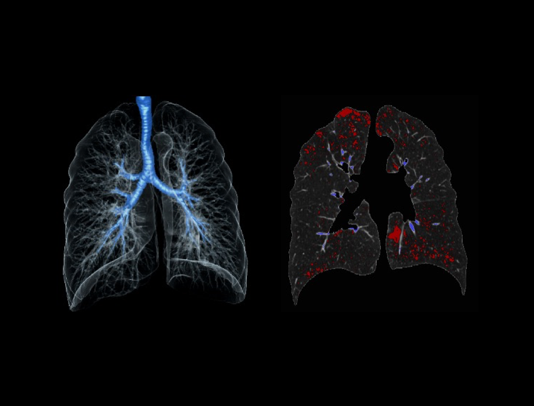 uCT 780 (Fine Sampling+ low Noise+ GOS) | United-Imaging