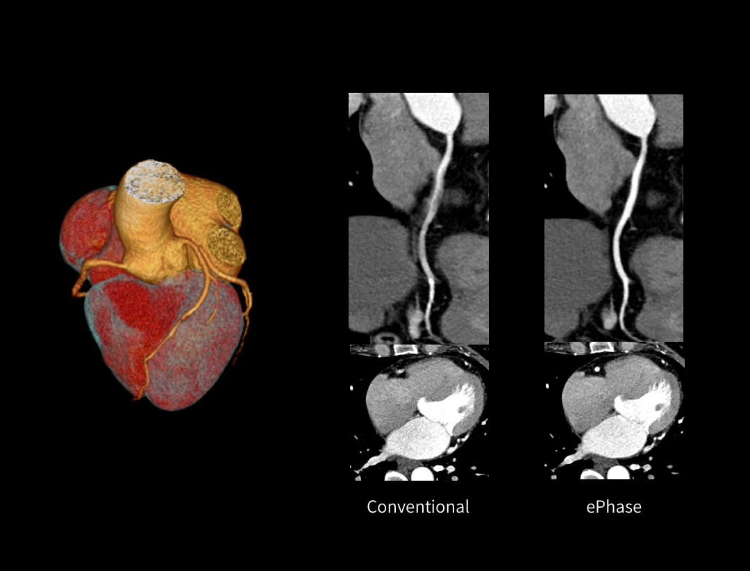 uCT 780 (Fine Sampling+ low Noise+ GOS) | United-Imaging