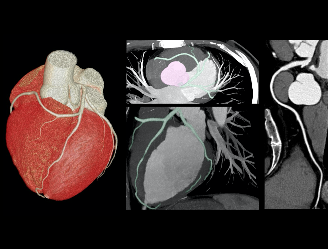 uCT 780 (Fine Sampling+ low Noise+ GOS) | United-Imaging